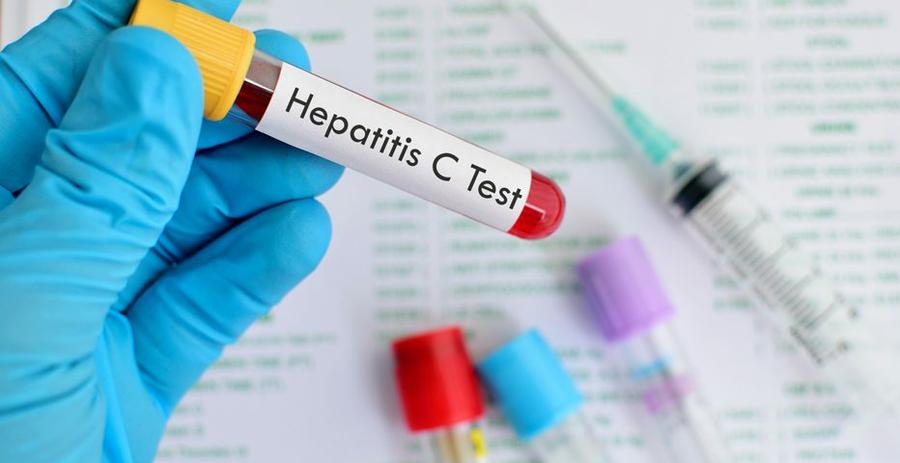 hepatt